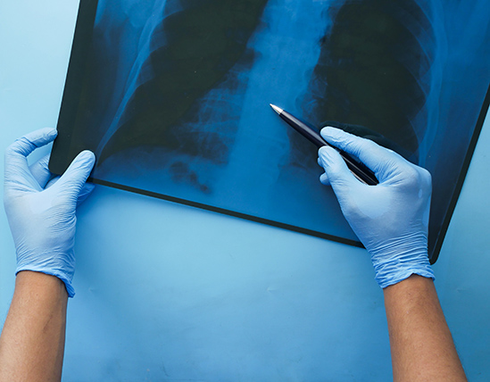 Consulenza onco-radiologica